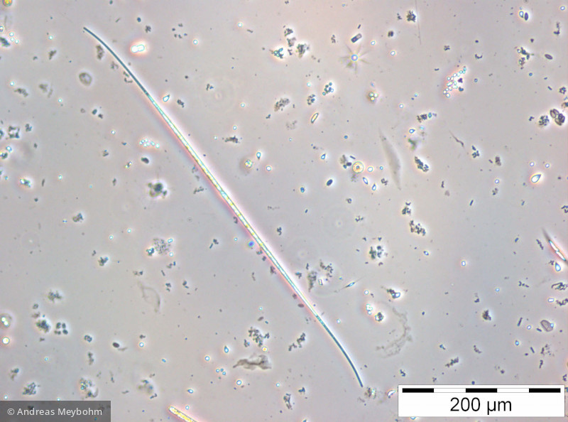 Closterium_acicularis_1252310914 - Chlorophyta Conjugatophyceae Desmidiales Closterium aciculare