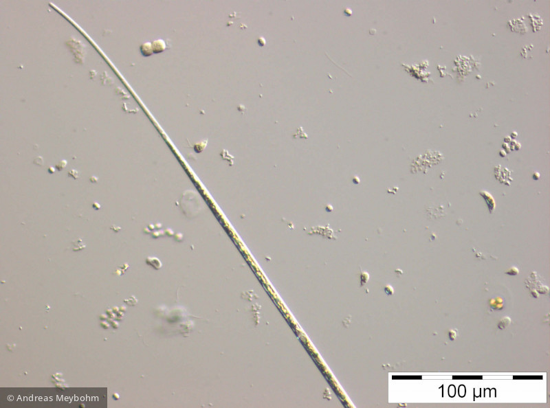 Closterium_acicularis_1252311271 - Chlorophyta Conjugatophyceae Desmidiales Closterium aciculare