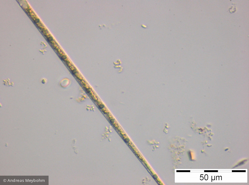 Closterium_acicularis_1252311637 - Chlorophyta Conjugatophyceae Desmidiales Closterium aciculare