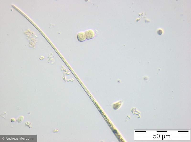 Closterium_acicularis_1252312057 - Chlorophyta Conjugatophyceae Desmidiales Closterium aciculare