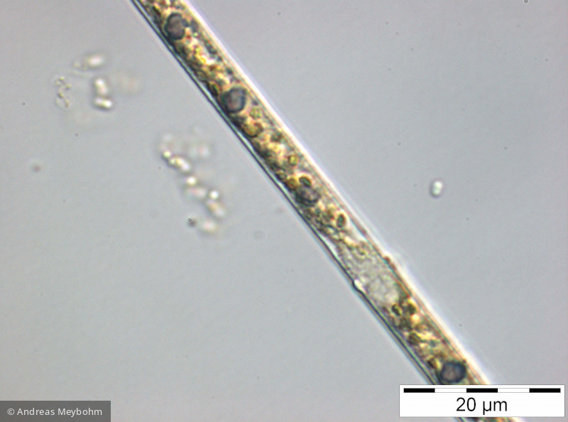 Closterium_acicularis_1252312131 - Chlorophyta Conjugatophyceae Desmidiales Closterium aciculare