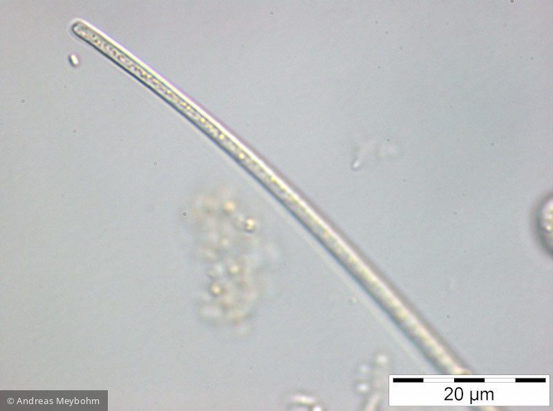 Closterium_acicularis_1252312652 - Chlorophyta Conjugatophyceae Desmidiales Closterium aciculare