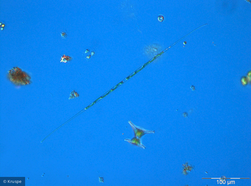 Closterium_aciculare_1260457327 - Chlorophyta Conjugatophyceae Desmidiales Closterium aciculare