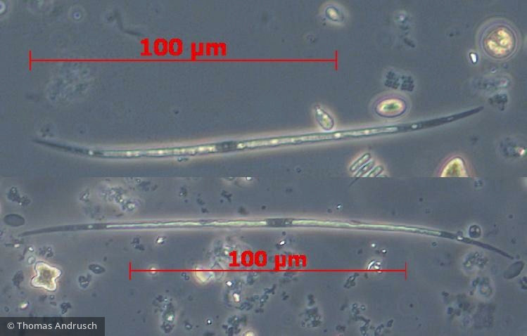 Chlorophyta Conjugatophyceae Desmidiales Closterium acutum var. linea