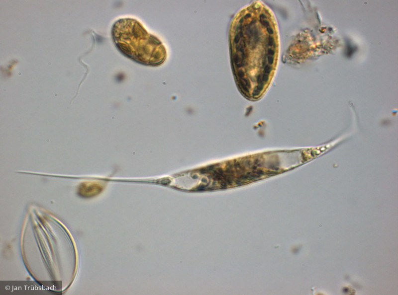 Ankyra ancora · Chlorophyta Chlorophyceae Chlorococcales · 1000x