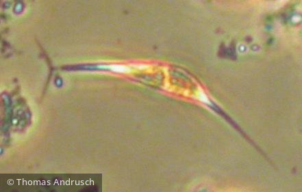 Ankyra ancora · Chlorophyta Chlorophyceae Chlorococcales · 400x