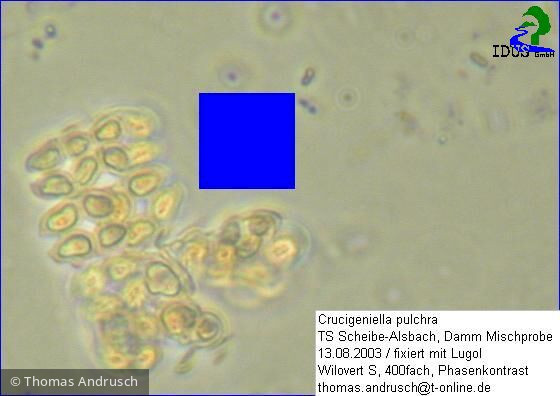 Crucigeniella_pulchra_1238670898 - Chlorophyta Chlorophyceae Chlorococcales Willea apiculata