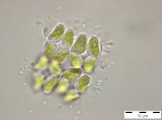 Crucigeniella_pulchra_1255348524