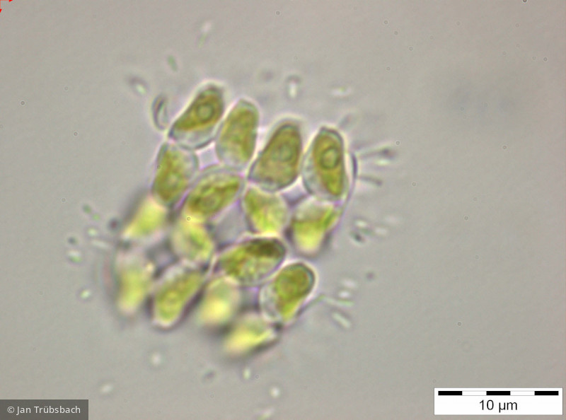 Crucigeniella_pulchra_1255348524 - Chlorophyta Chlorophyceae Chlorococcales Willea apiculata