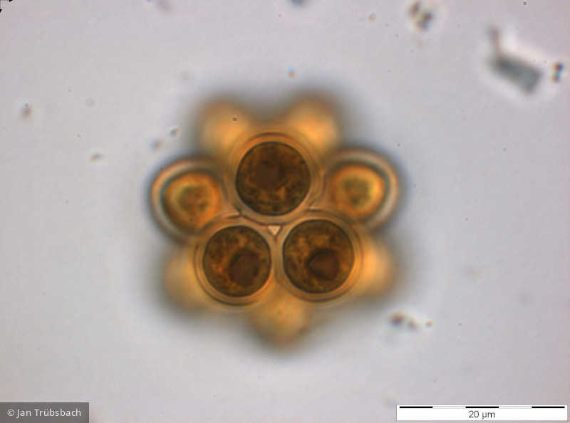 Chlorophyta Chlorophyceae Chlorococcales Coelastrum astroideum