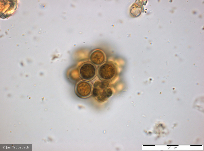 Chlorophyta Chlorophyceae Chlorococcales Coelastrum astroideum