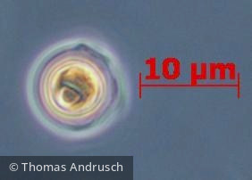 Chlorophyta Chlorophyceae Chlorococcales Coelastrum astroideum