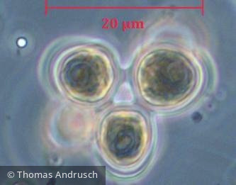 Chlorophyta Chlorophyceae Chlorococcales Coelastrum astroideum