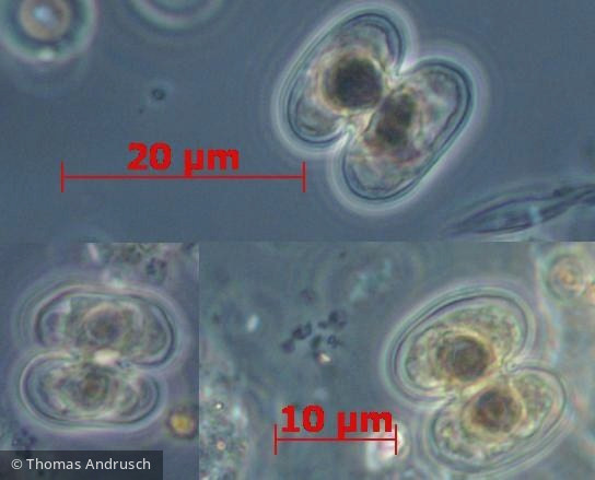 Chlorophyta Conjugatophyceae Desmidiales Cosmarium bioculatum