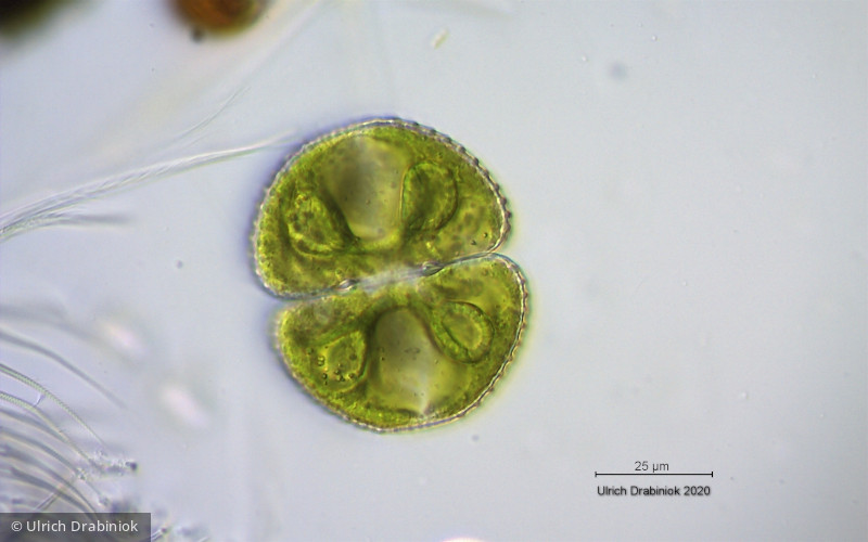 Chlorophyta Conjugatophyceae Desmidiales Cosmarium botrytis
