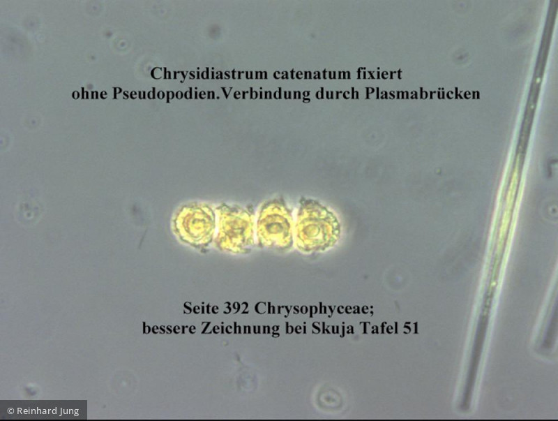 Chrysidiastrum_catenatum_1226581482 - Heterocontophyta Chrysophyceae Chromulinales Chrysidiastrum catenatum