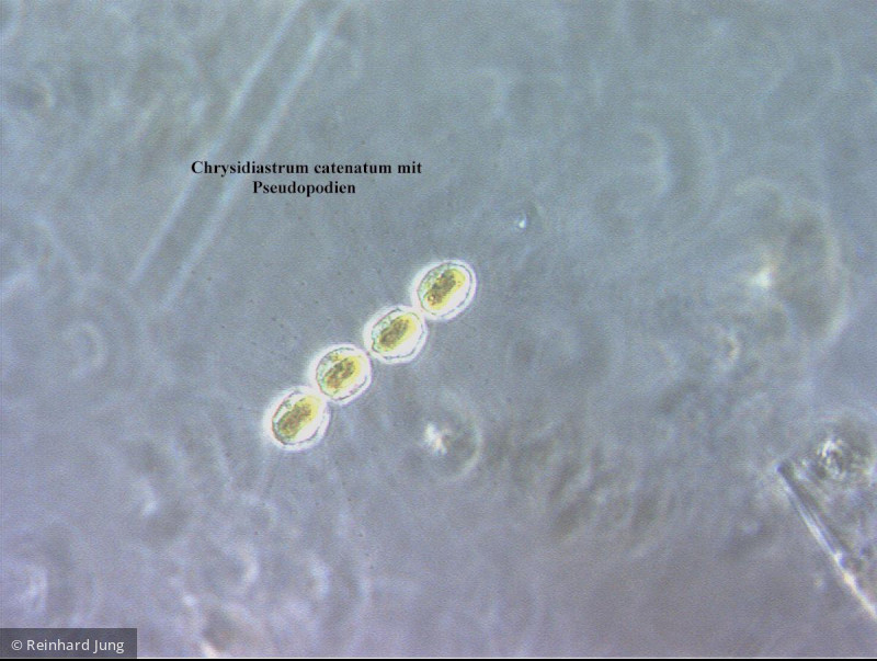 Chrysidiastrum_catenatum_1226581624 - Heterocontophyta Chrysophyceae Chromulinales Chrysidiastrum catenatum