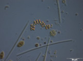 Anabaena_compacta_1260800547