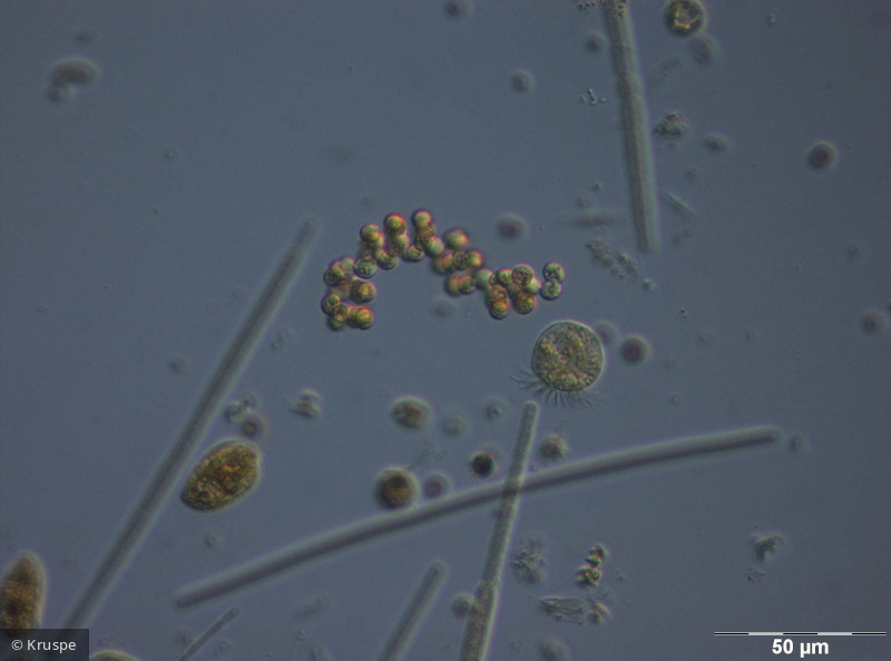 Anabaena_compacta_1260800547 - Cyanobacteria Cyanobacteria Nostocales Dolichospermum compactum