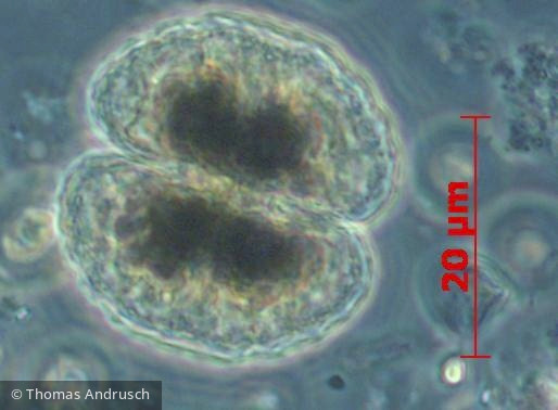 Chlorophyta Conjugatophyceae Desmidiales Cosmarium depressum