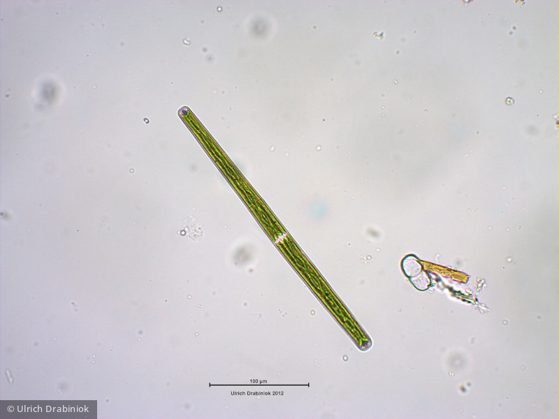 Chlorophyta Conjugatophyceae Desmidiales Closterium directum