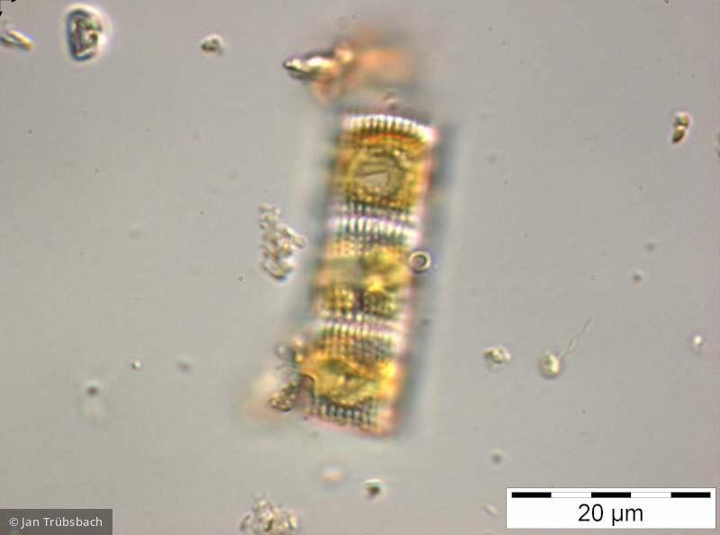 Aulacoseira_distans_1227718420