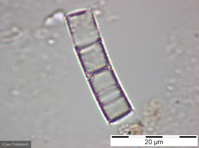 Aulacoseira_distans_1227773967