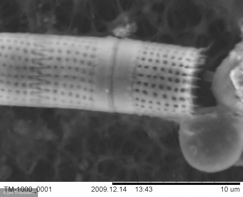 Aulacoseira_distans_1260797403