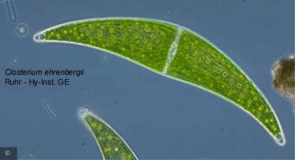 Closterium ehrenbergii · Chlorophyta Conjugatophyceae Desmidiales · 1219236401Closterium_ehrenbergii_att