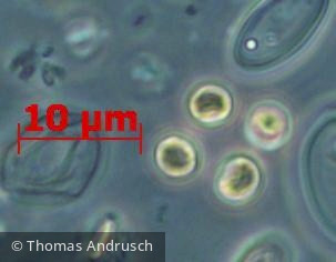 Chlorophyta Chlorophyceae Chlorococcales Coronastrum ellipsoideum