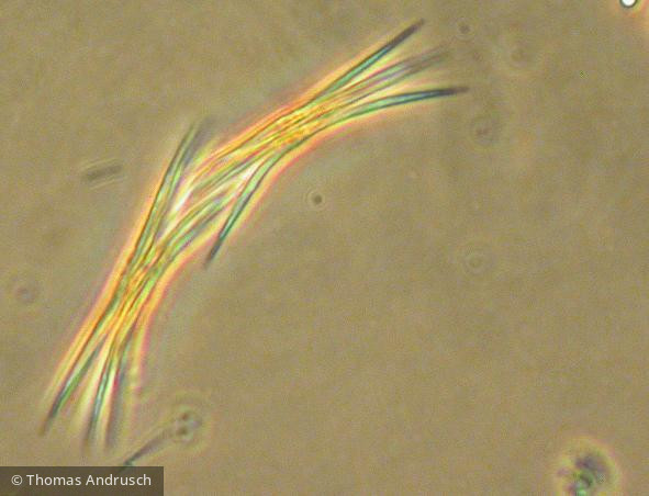 Ankistrodesmus_falcatus_1271441583