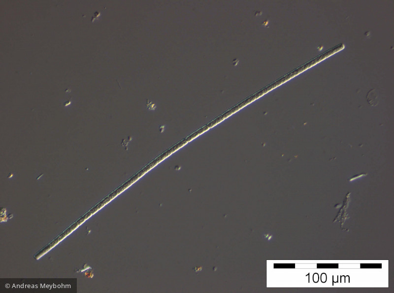 Aphanizomenon flos-aquae · Cyanobacteria Cyanobacteria Nostocales · 200x