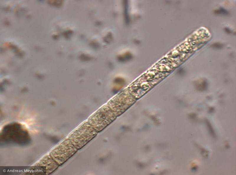 Aphanizomenon flos-aquae · Cyanobacteria Cyanobacteria Nostocales · 1000x