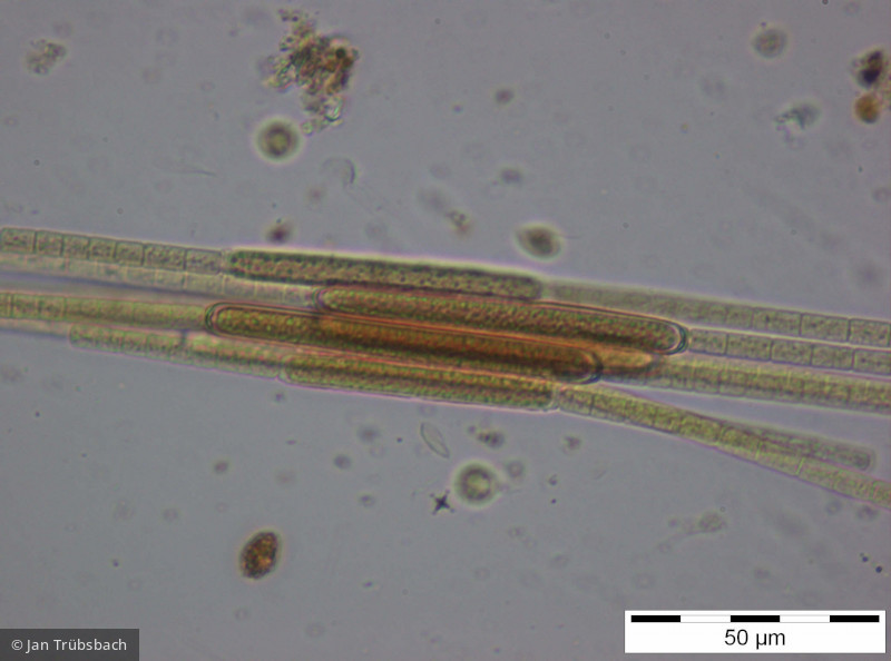 Aphanizomenon flos-aquae · Cyanobacteria Cyanobacteria Nostocales · 400x