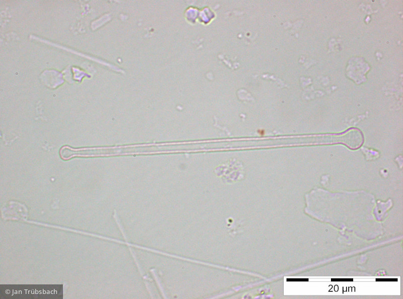 Asterionella_formosa_1259572900