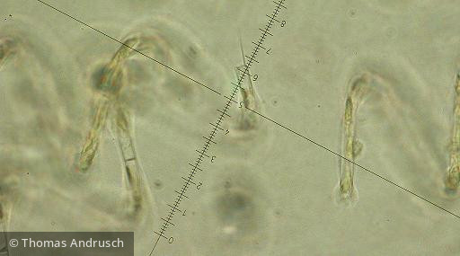 Aulacoseira_granulata_1271442272