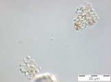 Cyanodictyon_imperfectum_1252314083