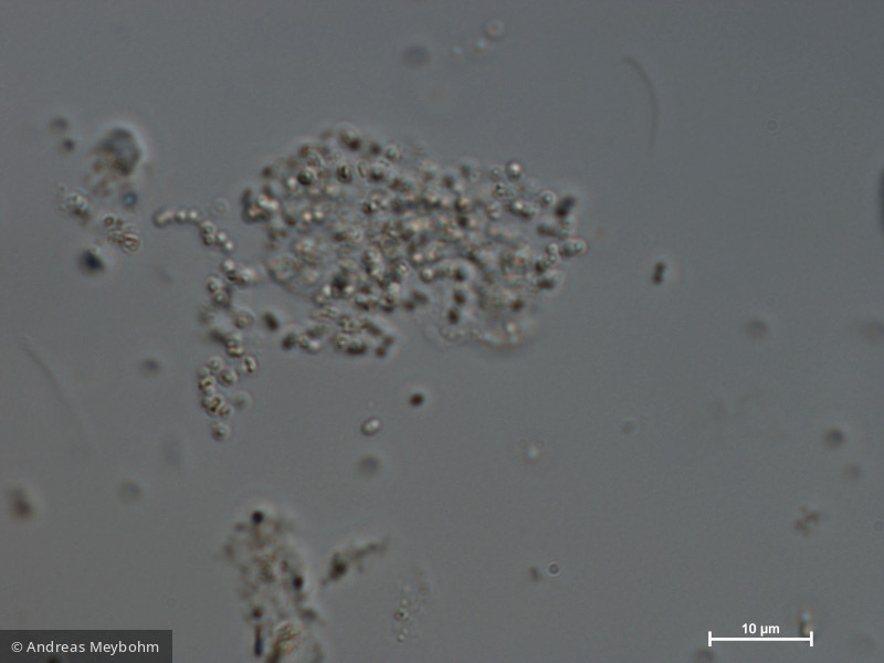 Cyanocatena_imperfecta_1280994403 - Cyanobacteria Cyanobacteria Chroococcales Cyanodictyon imperfectum