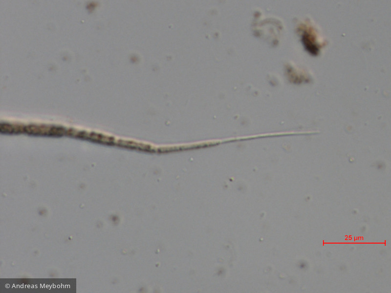 Cyanobacteria Cyanobacteria Nostocales Cuspidothrix issatschenkoi