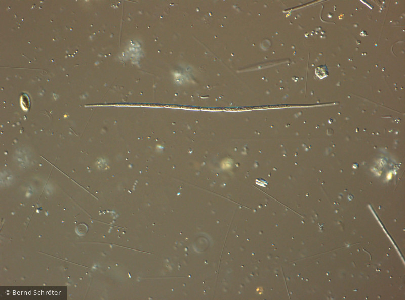 Cyanobacteria Cyanobacteria Nostocales Cuspidothrix issatschenkoi