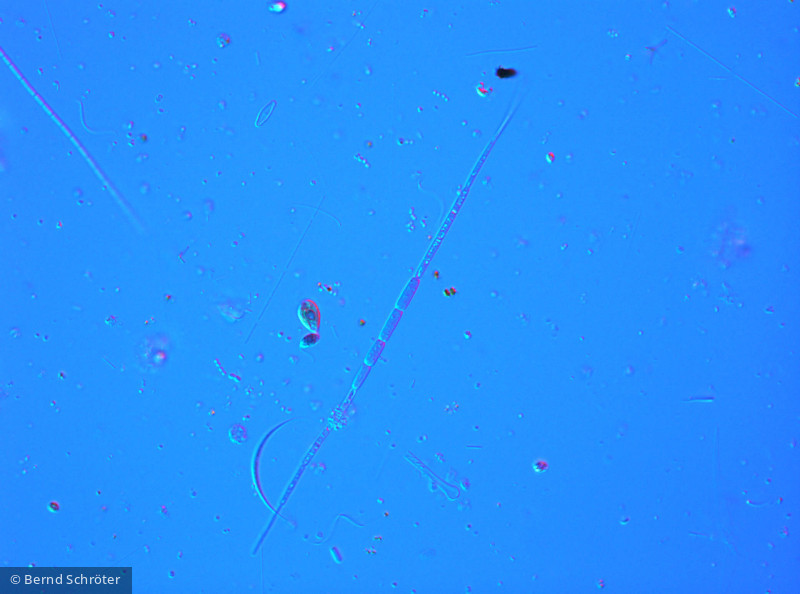 Cyanobacteria Cyanobacteria Nostocales Cuspidothrix issatschenkoi