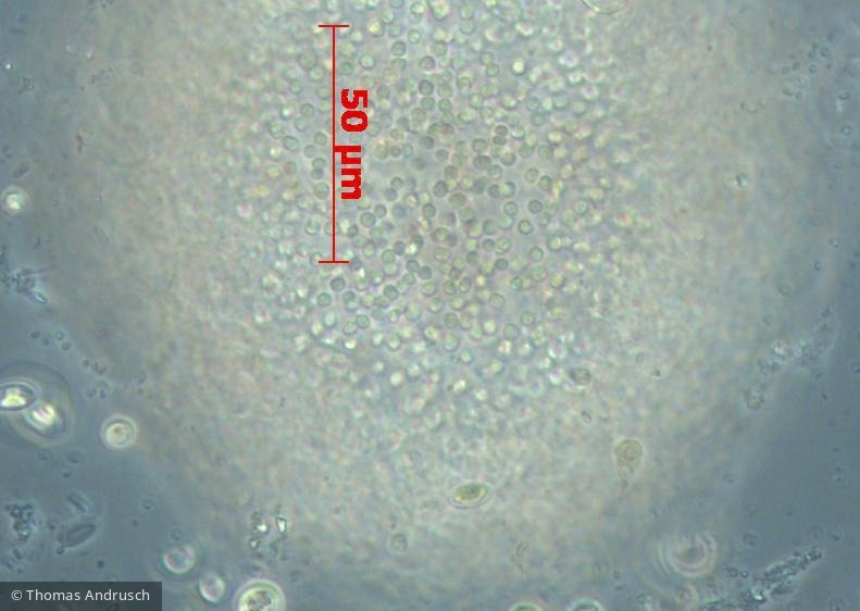 Cyanobacteria Cyanobacteria Chroococcales Coelosphaerium kuetzingianum