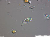 Achnanthes_lanceolata_1270554210