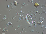 Achnanthes_lanceolata_1270554457