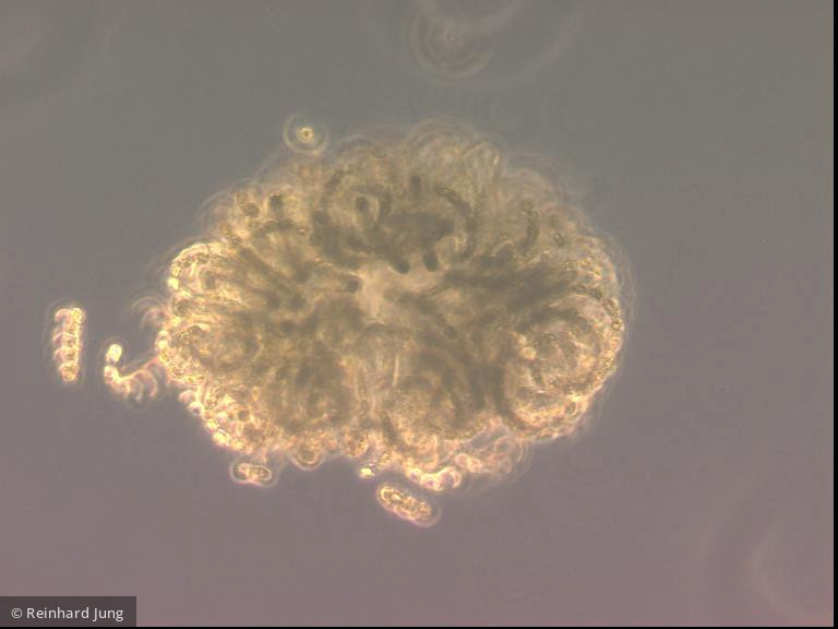 Cyanobacteria Cyanobacteria Nostocales Dolichospermum lemmermannii