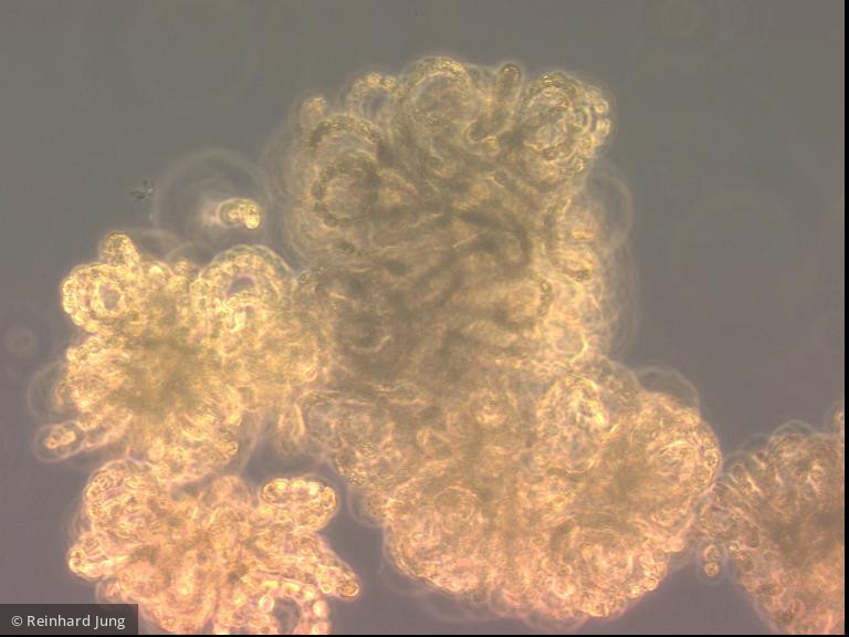 Cyanobacteria Cyanobacteria Nostocales Dolichospermum lemmermannii