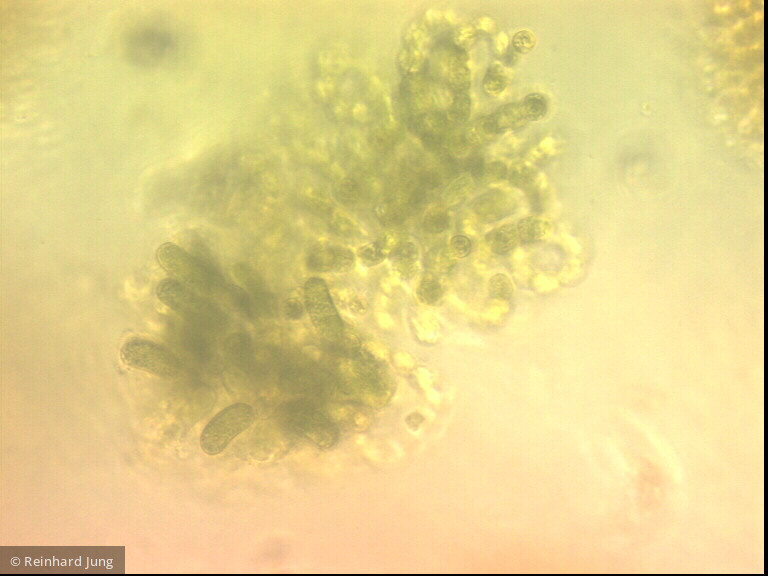 Cyanobacteria Cyanobacteria Nostocales Dolichospermum lemmermannii