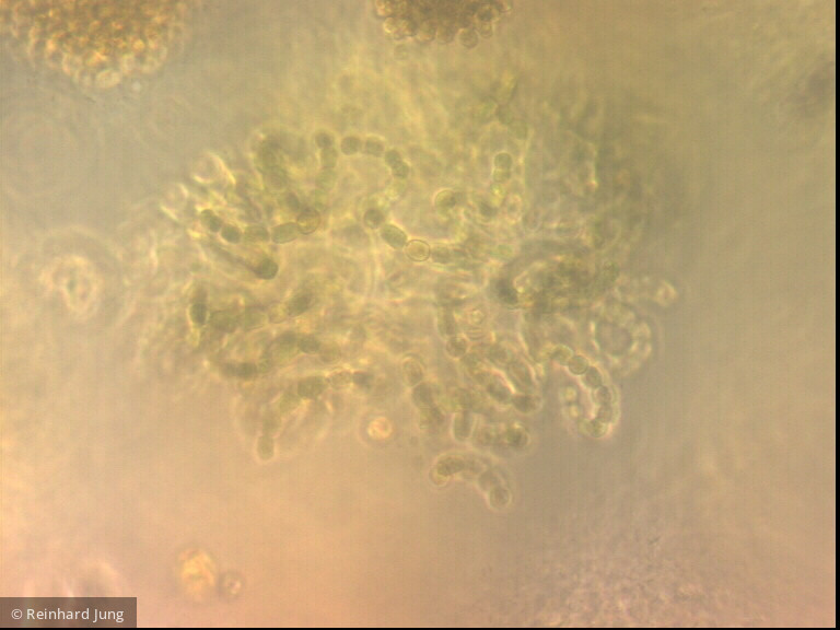Cyanobacteria Cyanobacteria Nostocales Dolichospermum lemmermannii