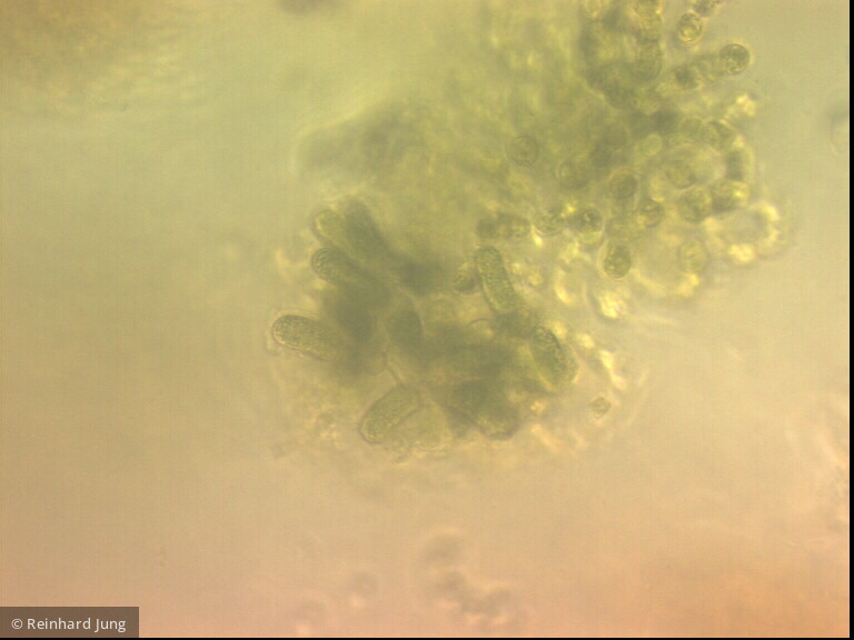 Cyanobacteria Cyanobacteria Nostocales Dolichospermum lemmermannii