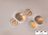 Chroococcus limneticus